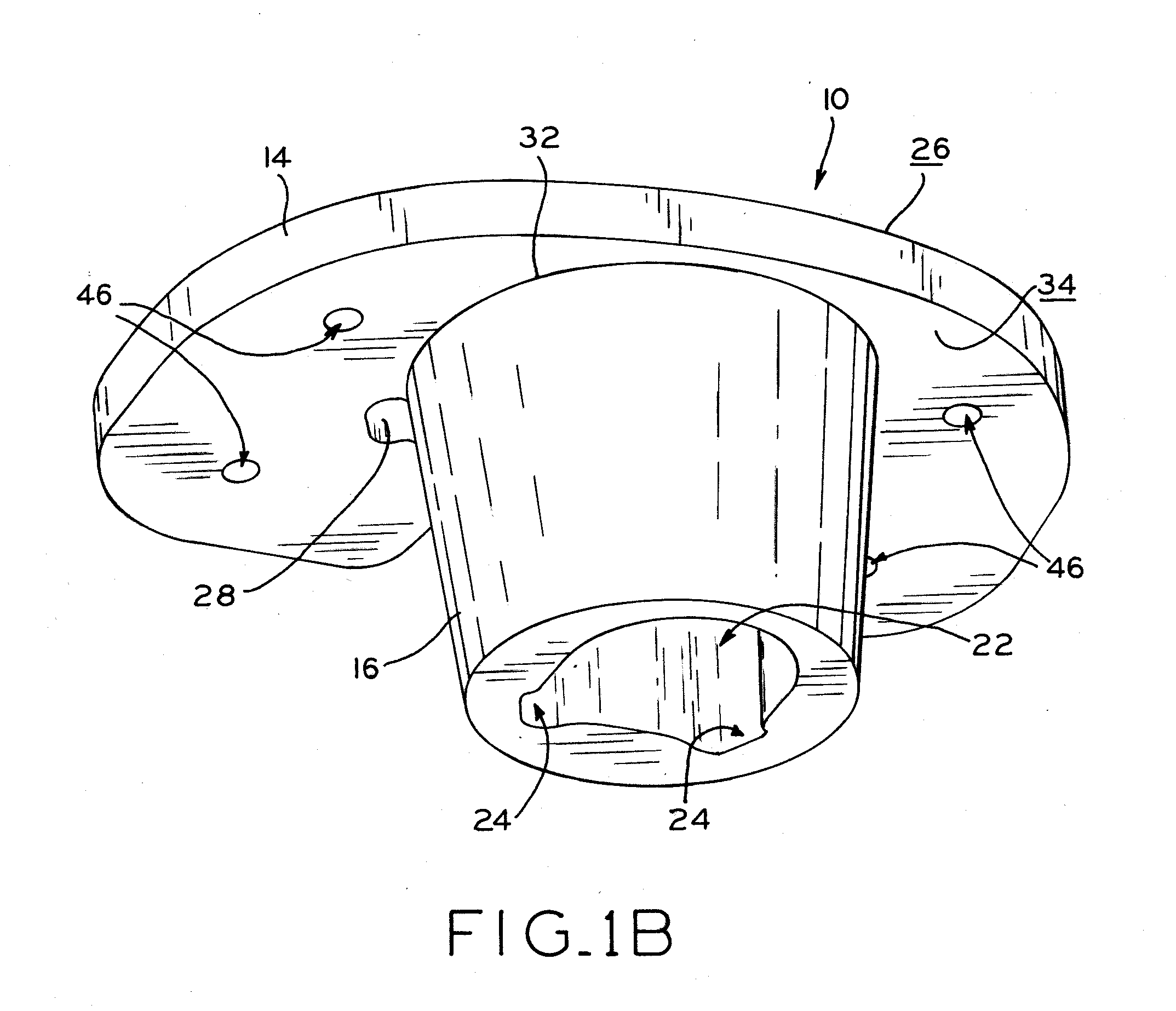 Stabilizing prosthesis support structure