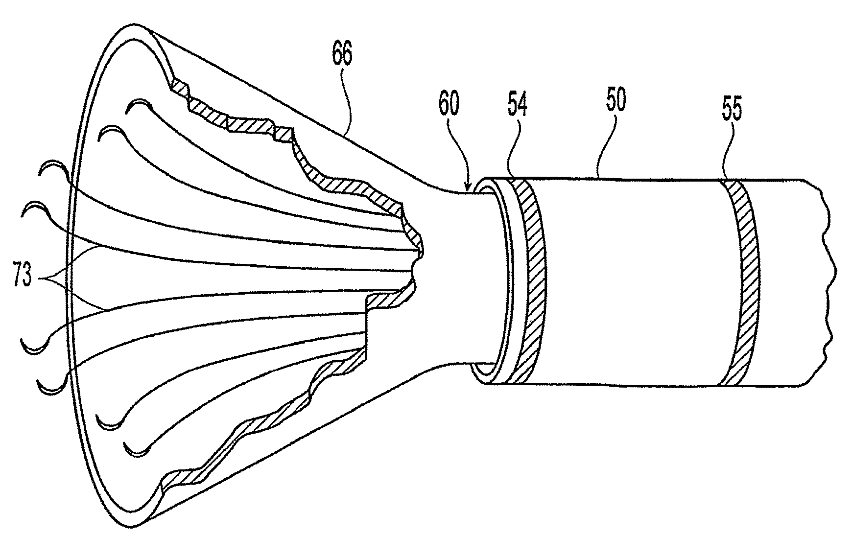 Embolus blood clot filter removal system and method