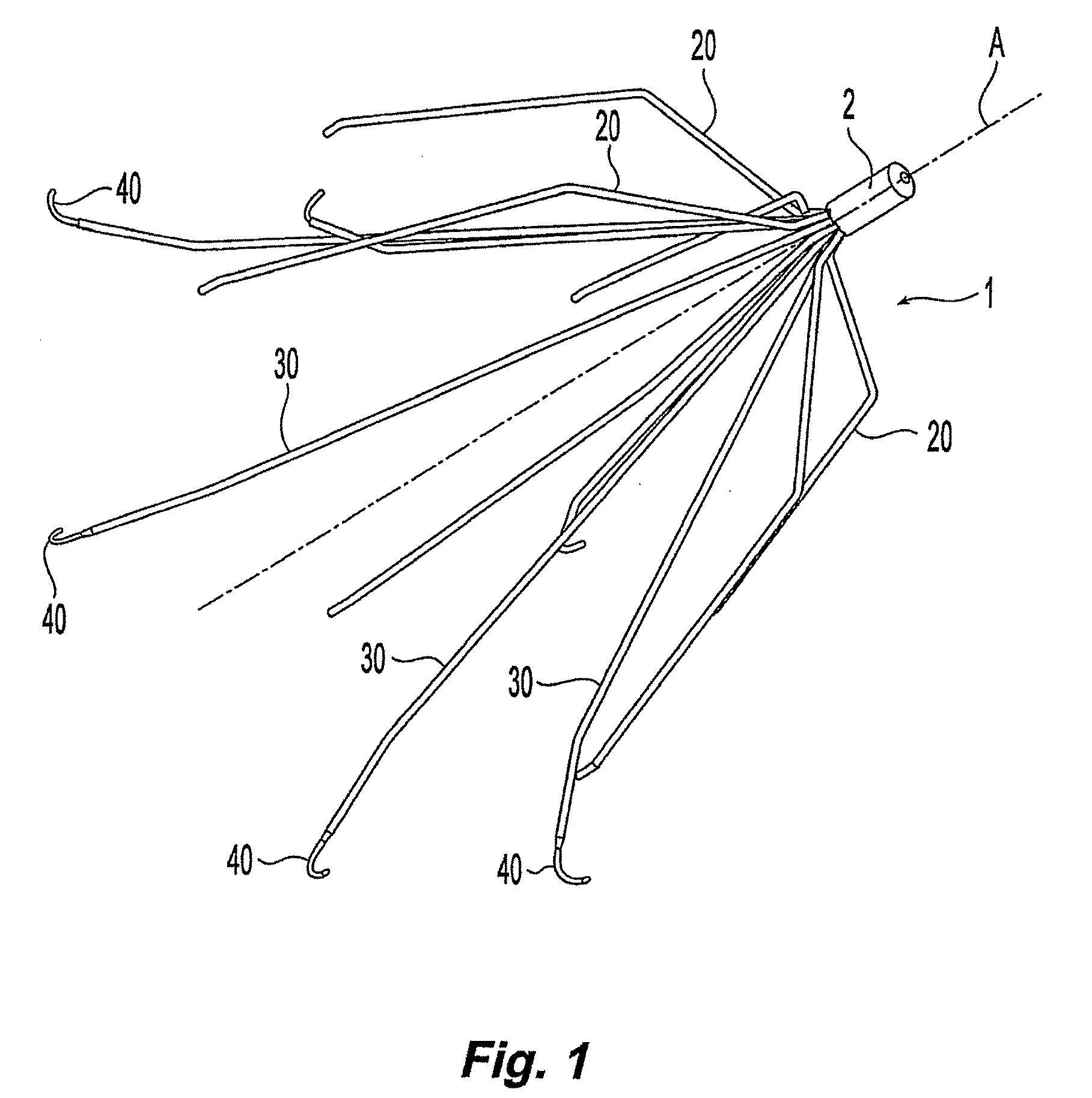 Embolus blood clot filter removal system and method