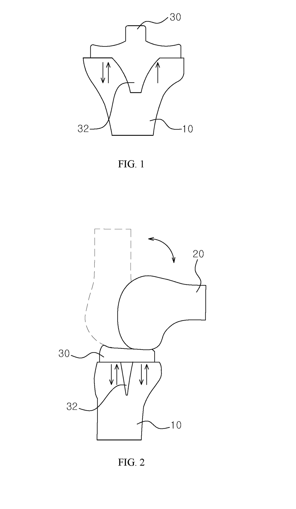 Knee joint implant