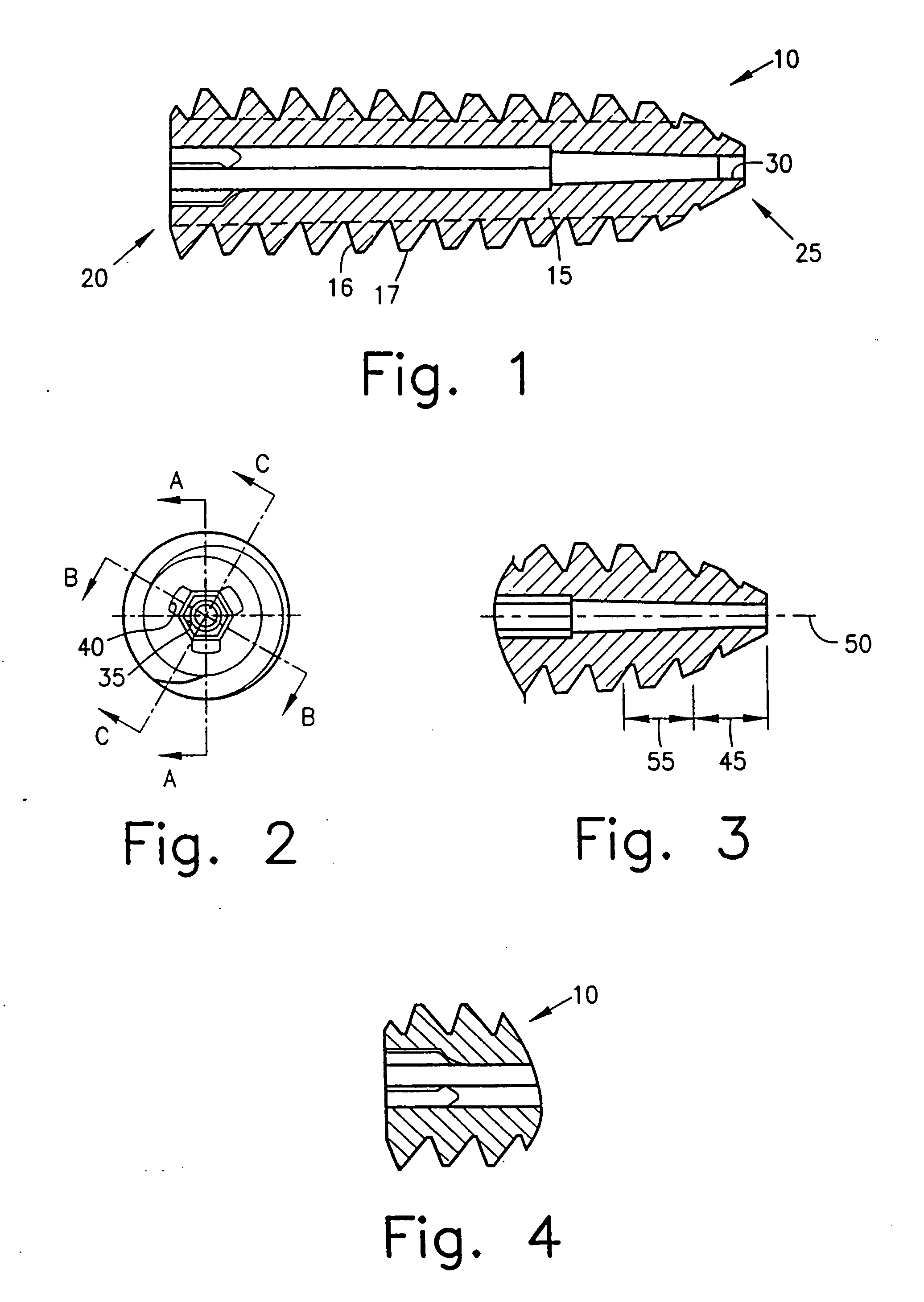 Tapered bioabsorbable interference screw for endosteal fixation of ligaments