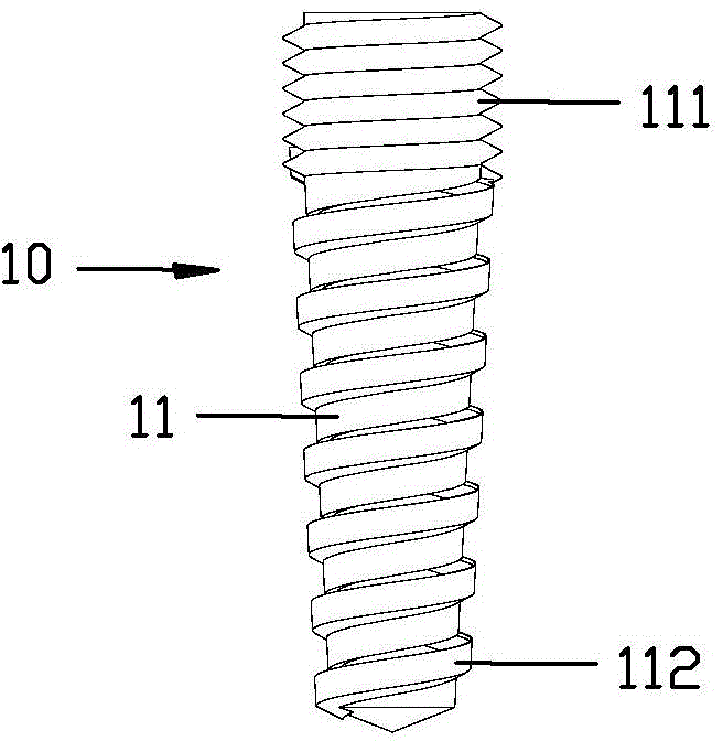 Implant tooth