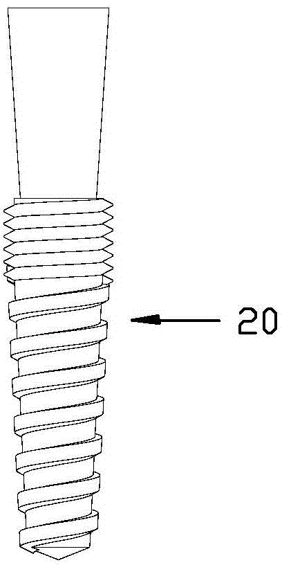 Implant tooth