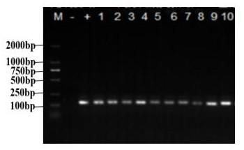 PCR identification method for kangfuxin solution