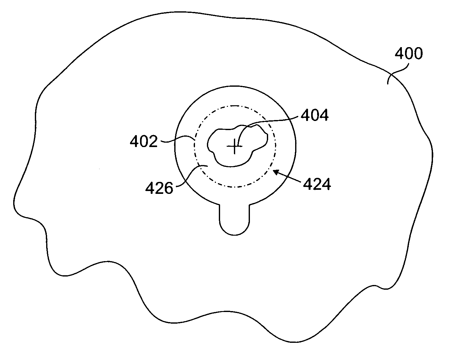 Hole repair technique and apparatus