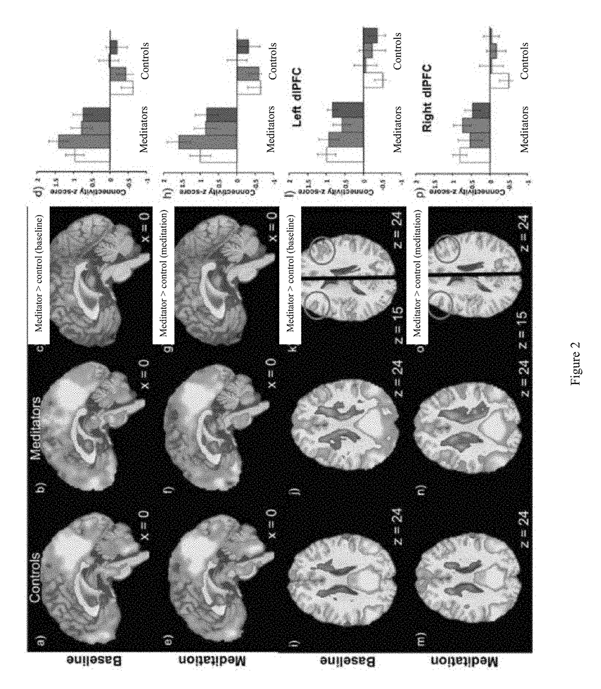 Method of correlating brain activity