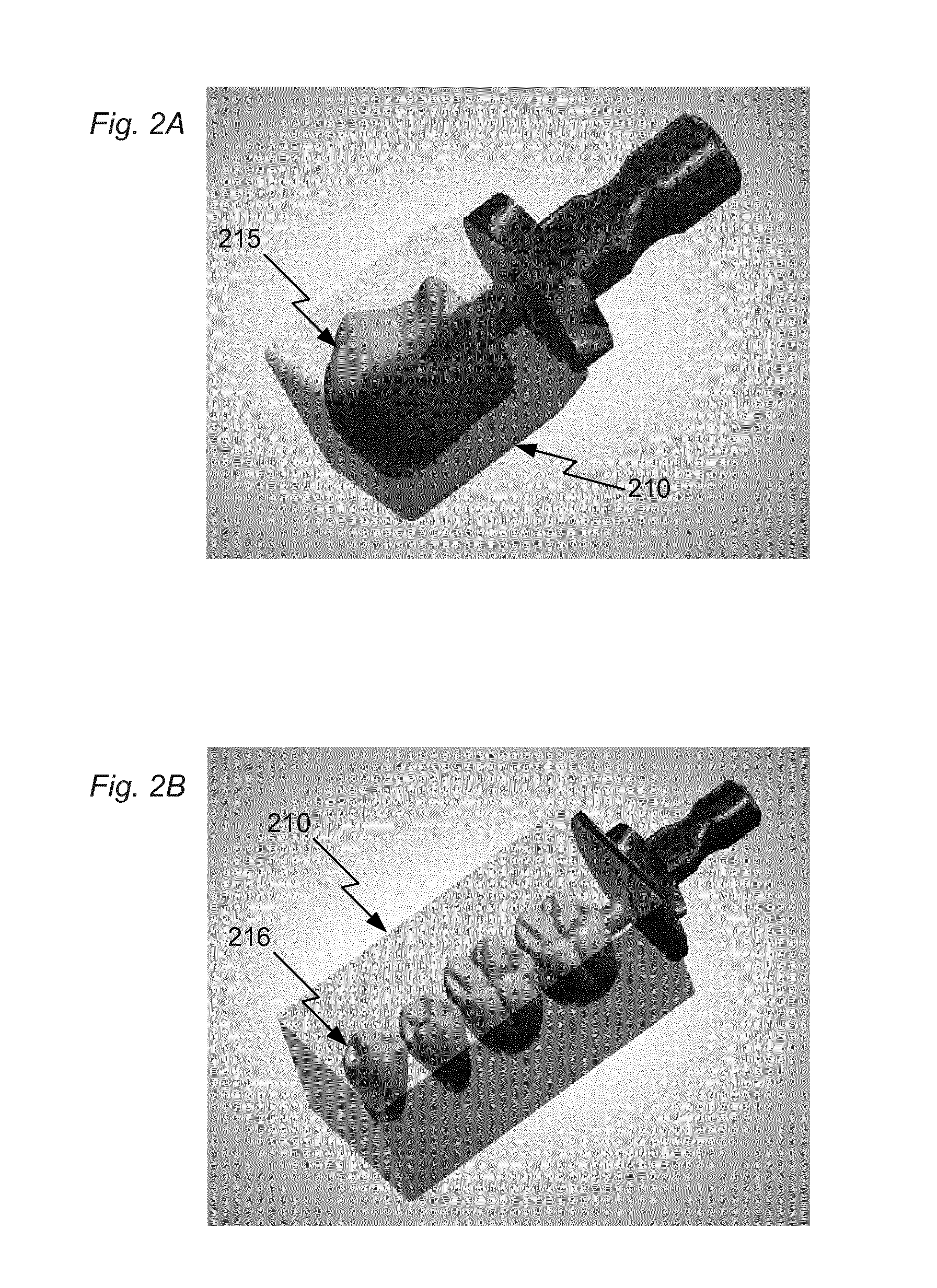 Method and user interface for use in manufacturing multi-shaded dental restorations