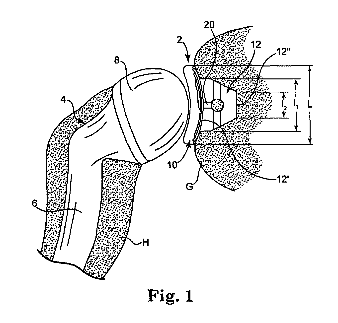 Glenoid component with an anatomically optimized keel