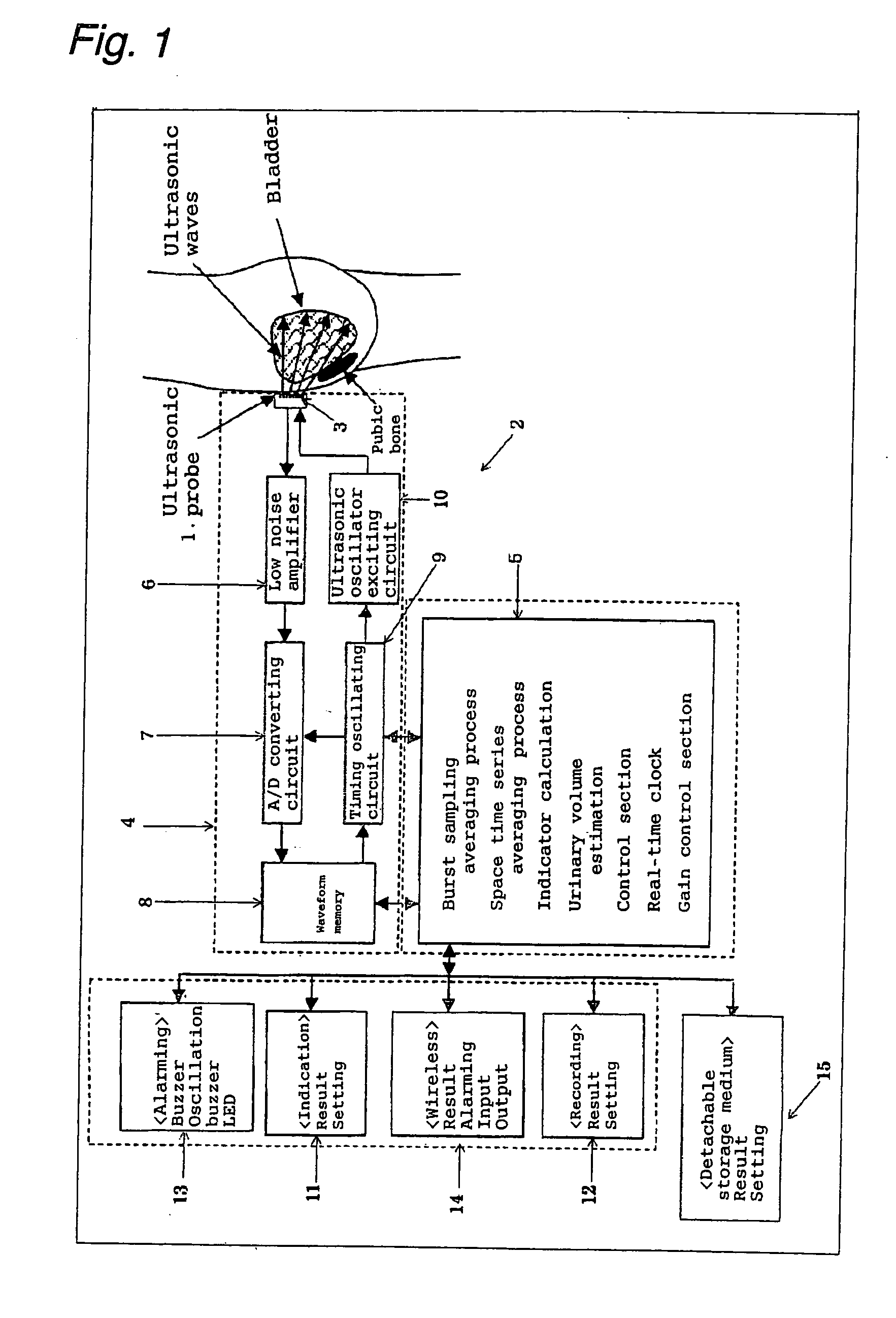 Ultrasonic Urinary Volume Sensor