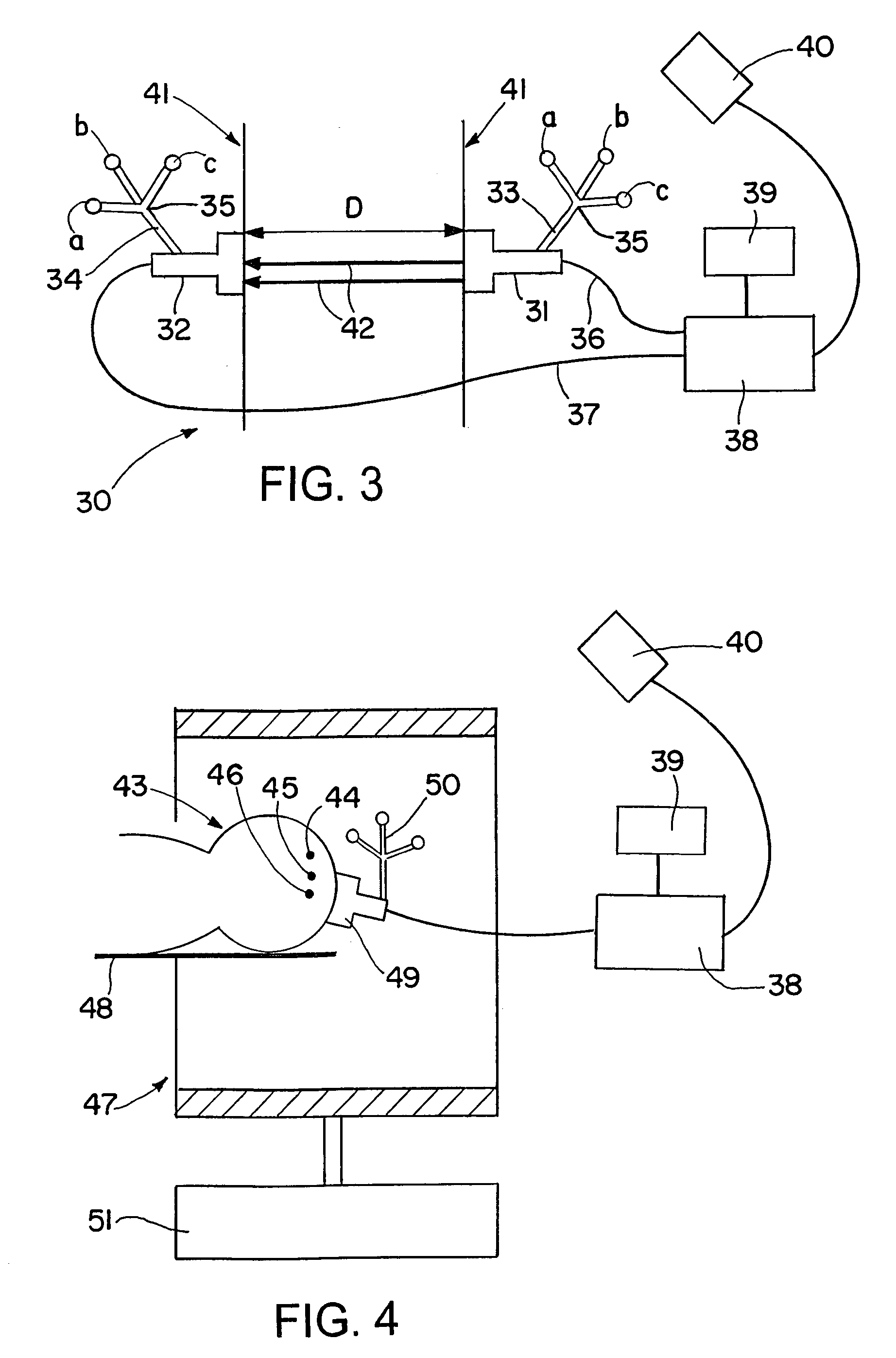 Determination of sound propagation speed in navigated surgeries