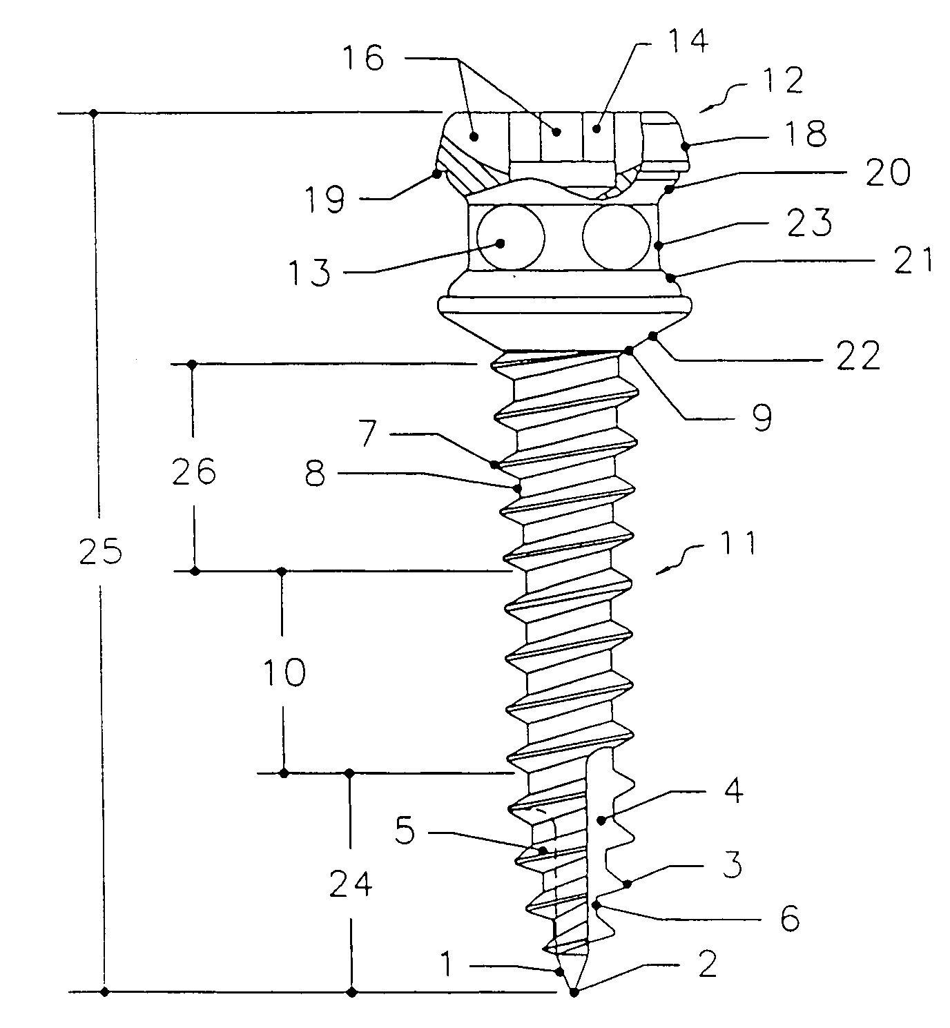 Orthodontic bone screw