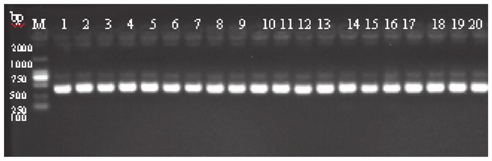 Primers and method for detecting single nucleotide polymorphism of GCKR gene by utilizing HRM technology