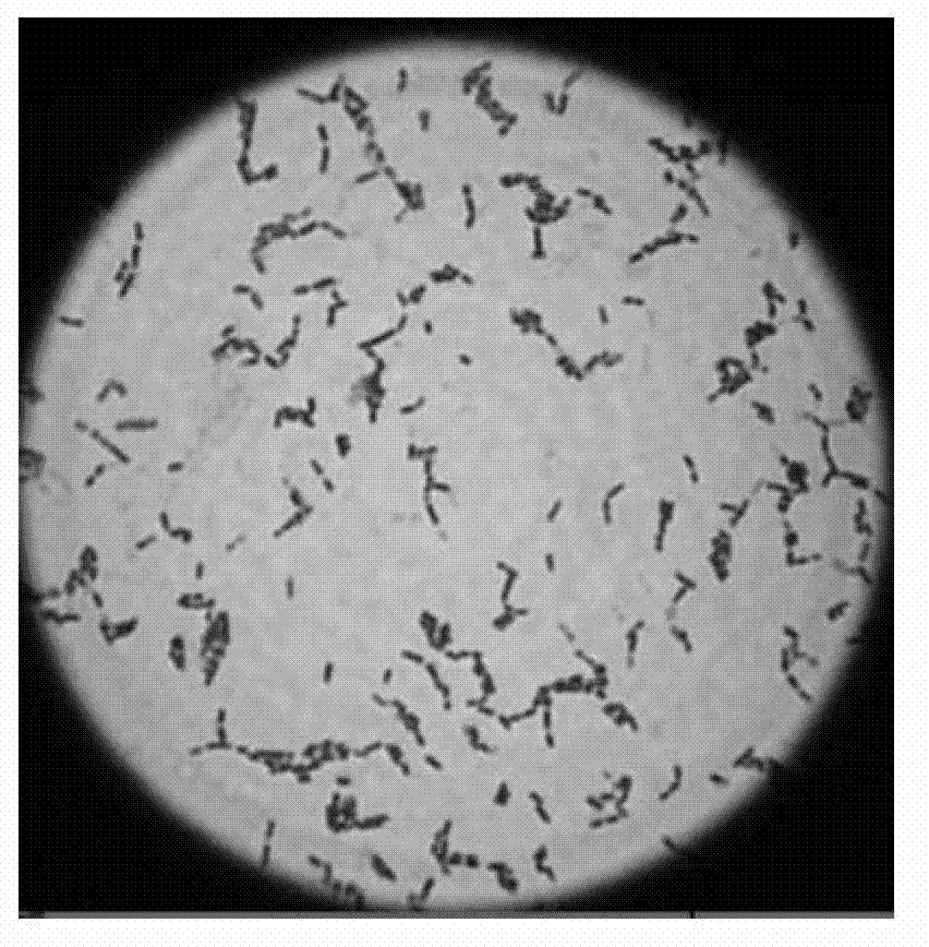 Lactobacillus jensenii for preventing and curing bacterial vaginosis