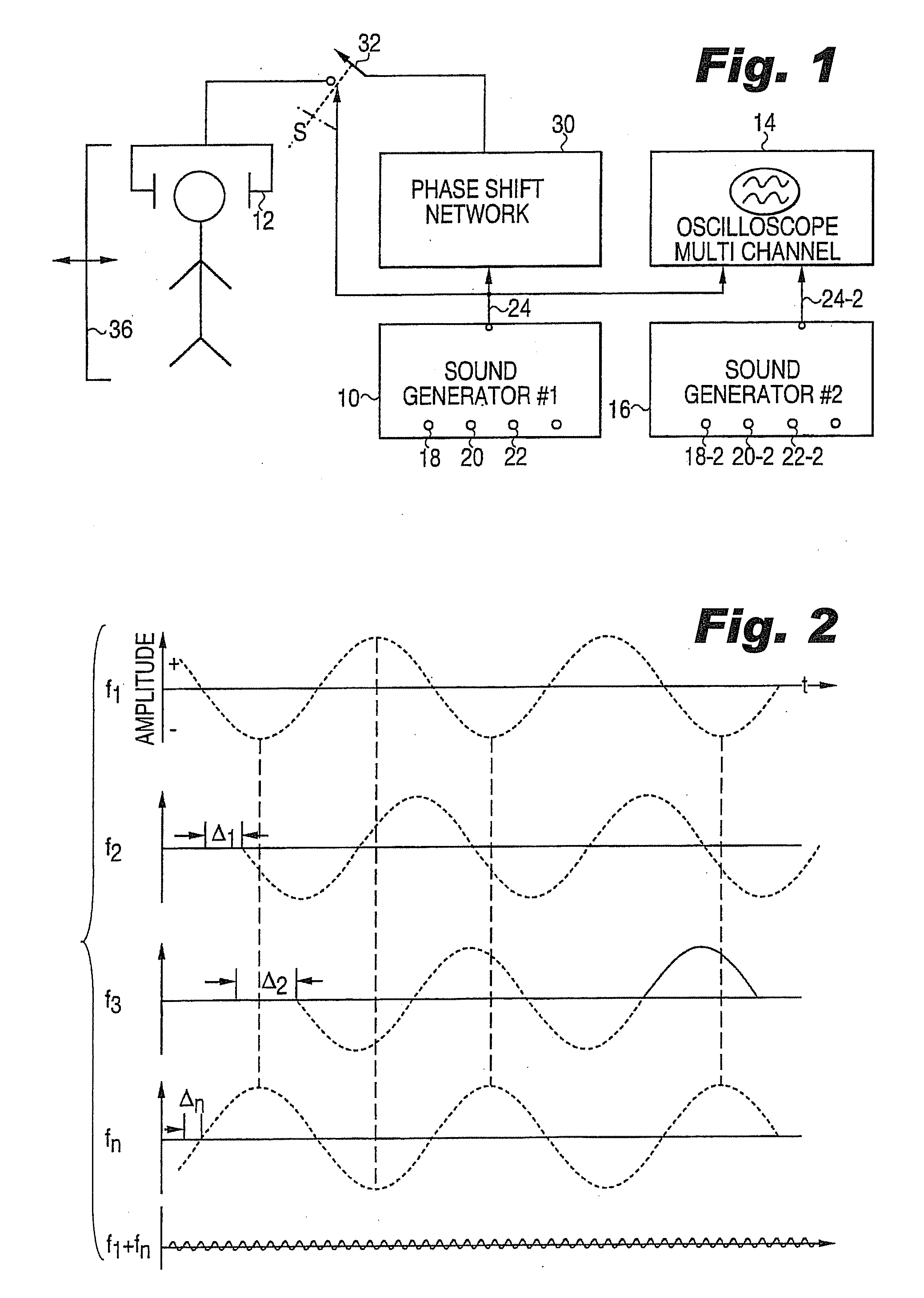 Method and Apparatus for Treatment of Monofrequency Tinnitus Utilizing Sound Wave Cancellation Techniques