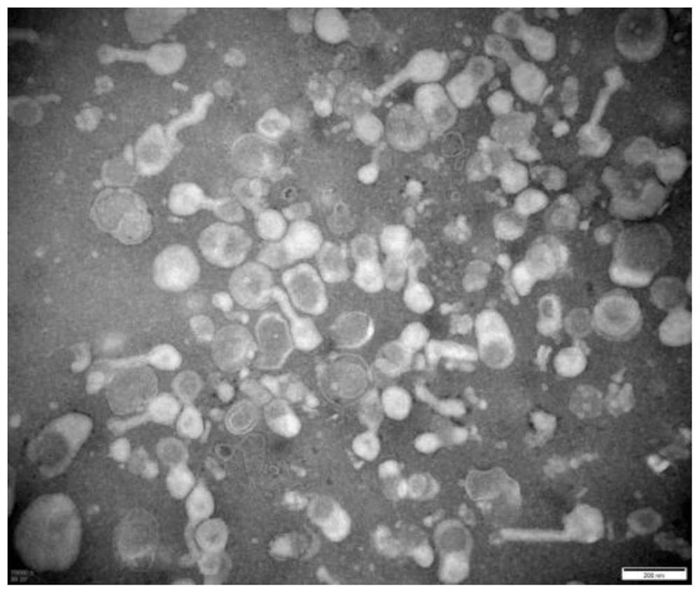 Application of mesenchymal stem cell exosome