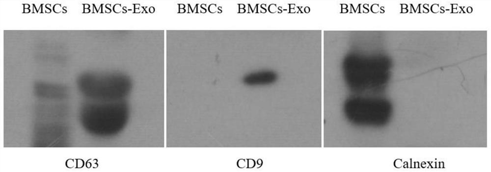 Application of mesenchymal stem cell exosome