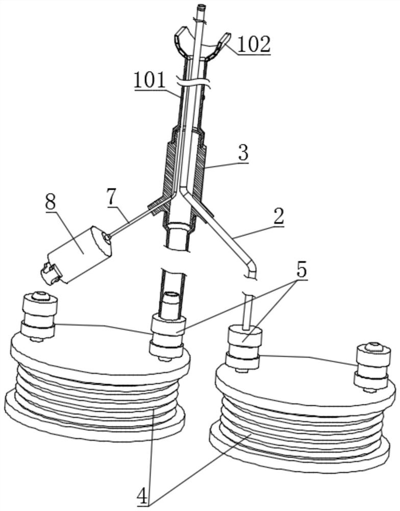 A catheter drainage device for biliary and pancreatic surgery