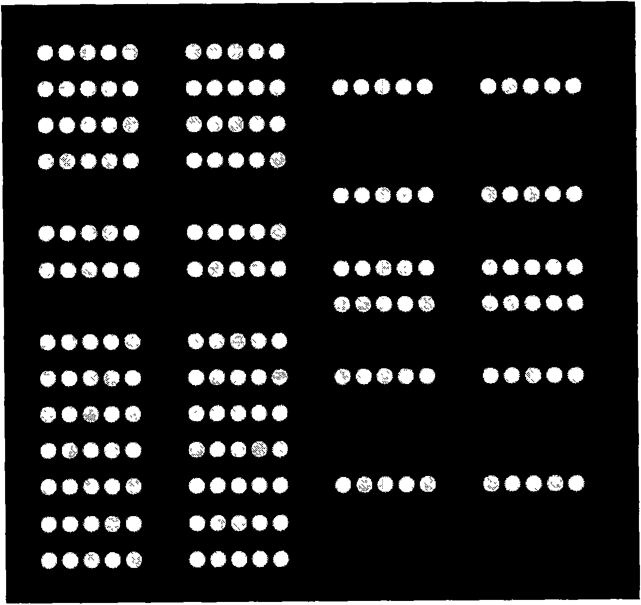 Method for detecting related gene mutations of diabetes drug treatment as well as special chip and kit thereof