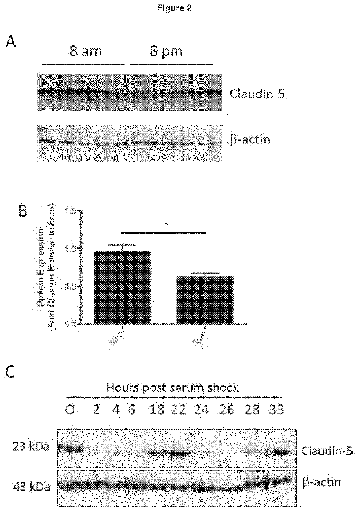 Treatment of age-related macular degeneration