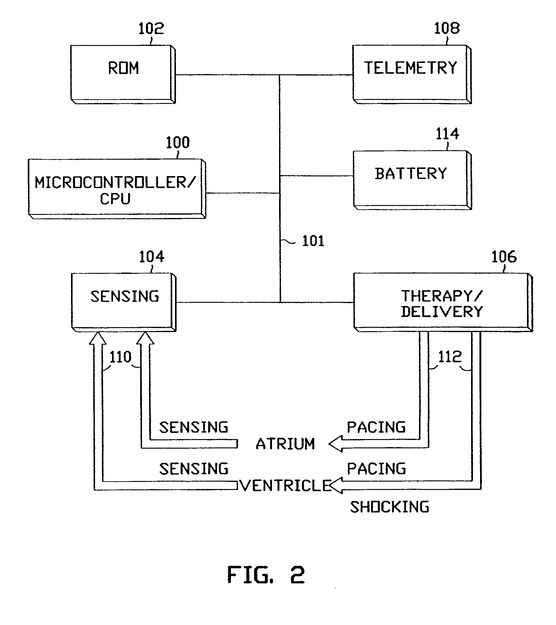 Apparatus and method for treating ventricular tachyarrhythmias