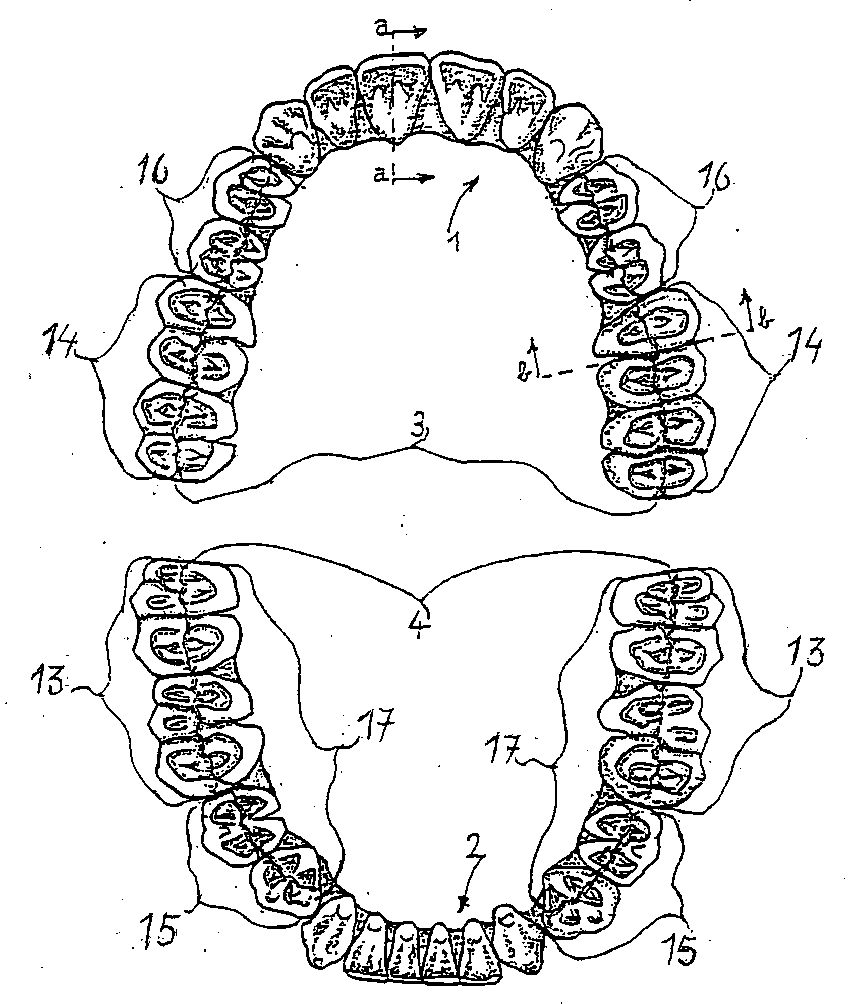 Combination set of artificial teeth units for setting-up dentures in balanced articulation