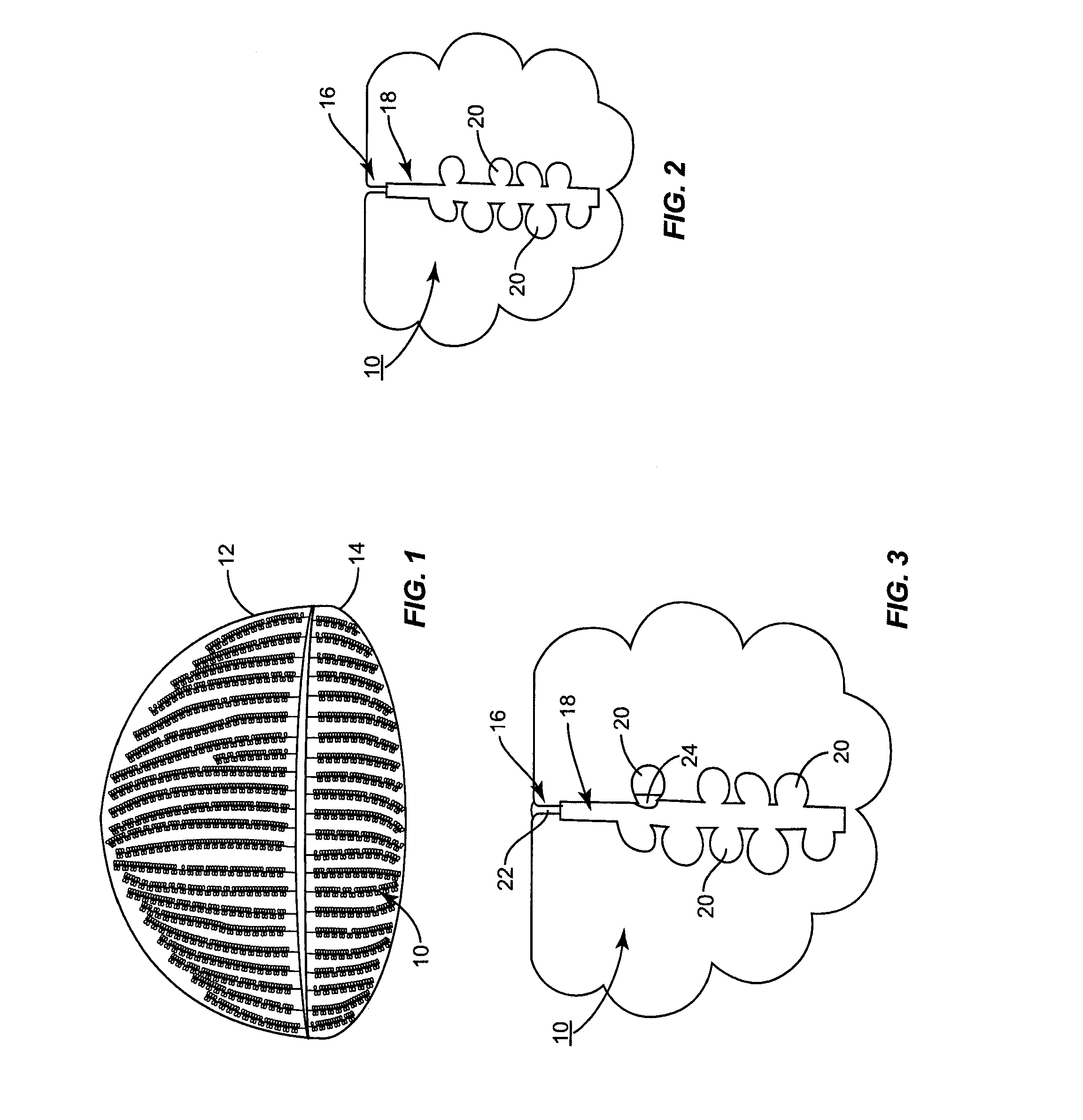 Inner eyelid heat and pressure treatment for treating meibomian gland dysfunction