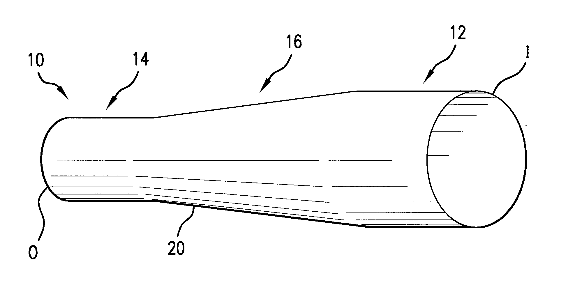 Method and apparatus for stenting