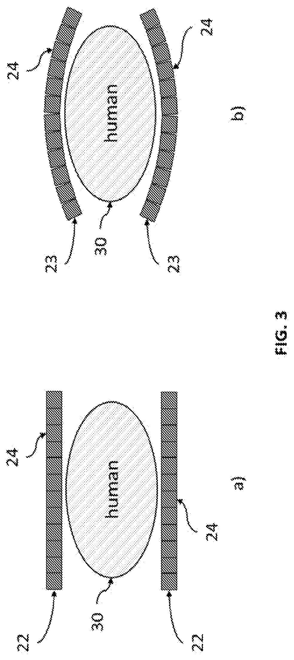 Transformable gamma cameras