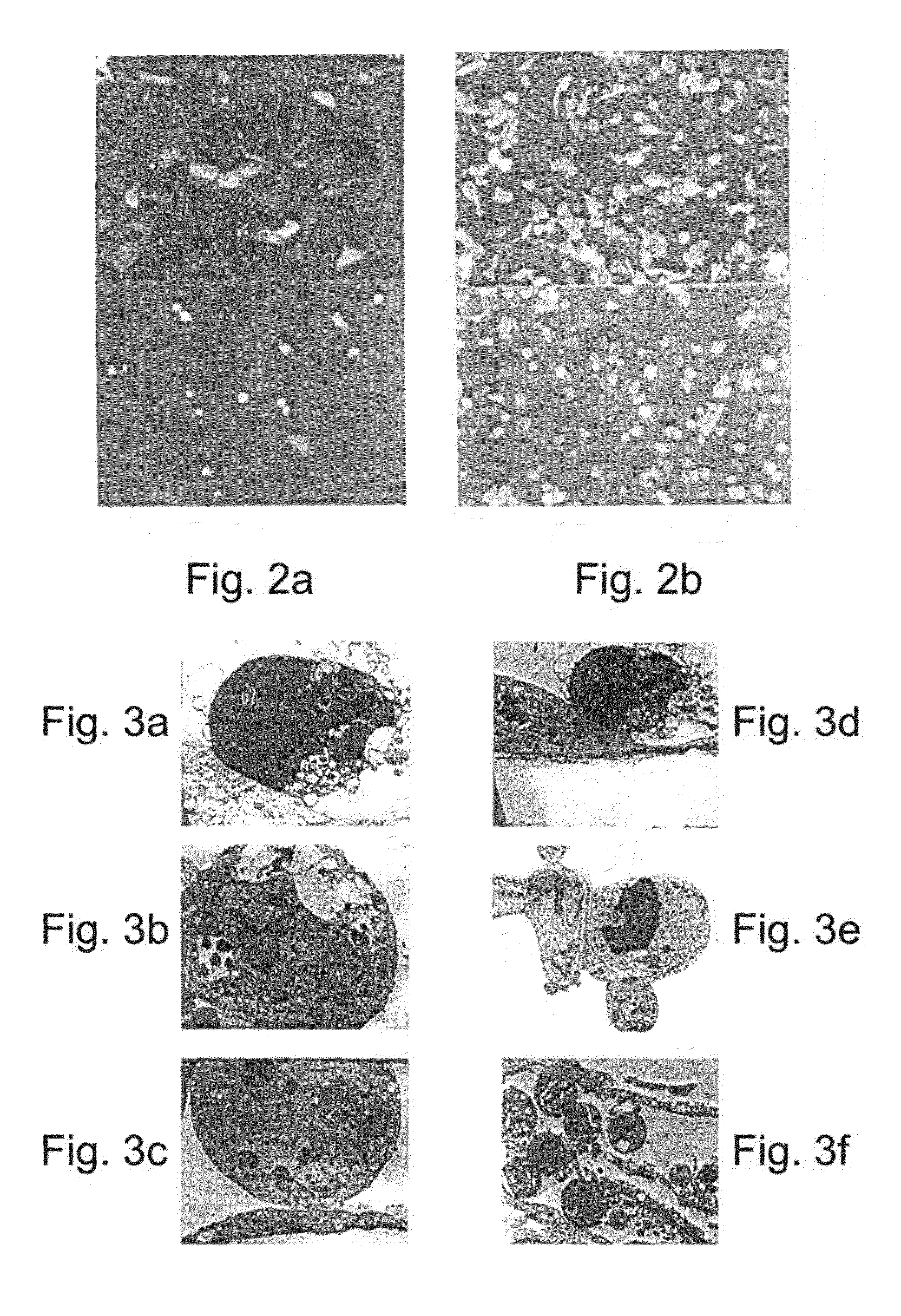 Promoters exhibiting endothelial cell specificity and methods of using same for regulation of angiogenesis