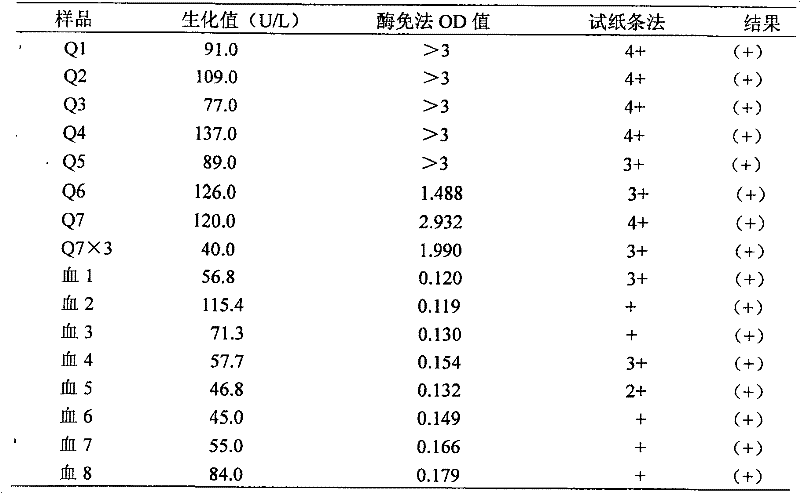 Alanine aminopherase monoclonal antibody and use thereof