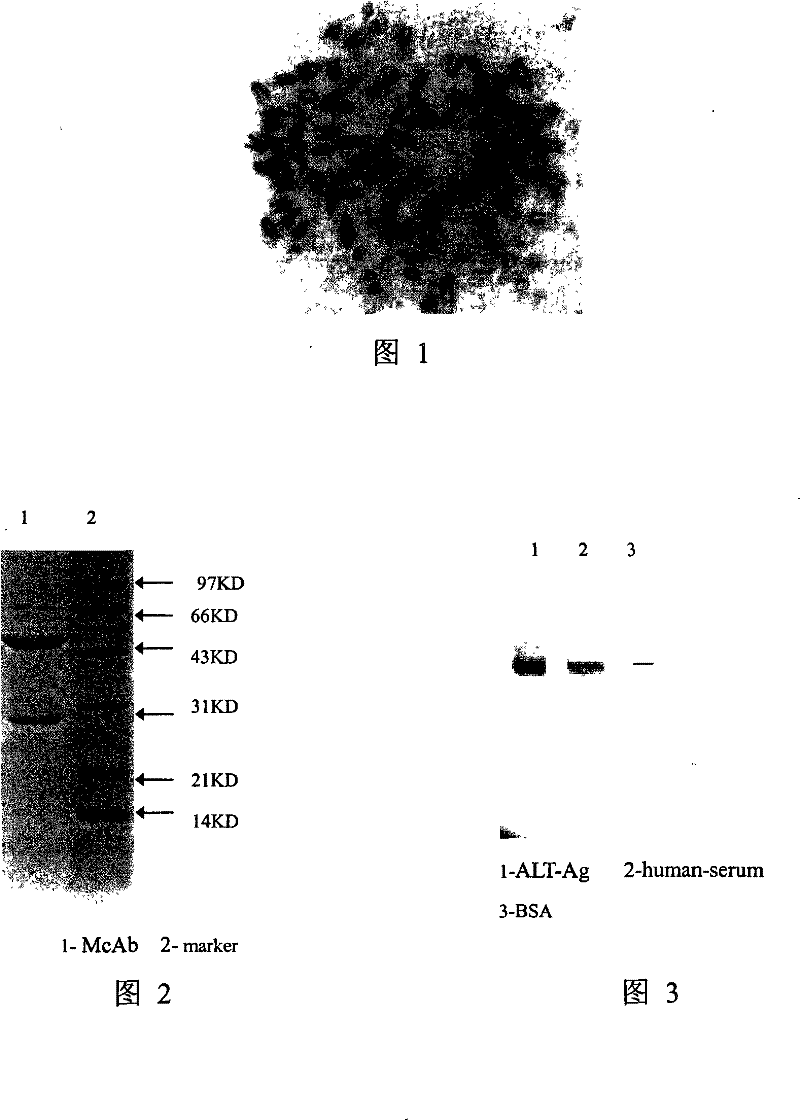 Alanine aminopherase monoclonal antibody and use thereof