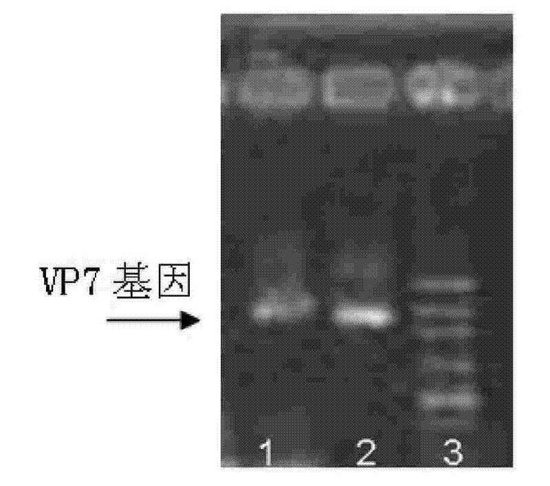 Recombined bifidobacteria -hRV/VP7 expression vector and oral vaccine thereof