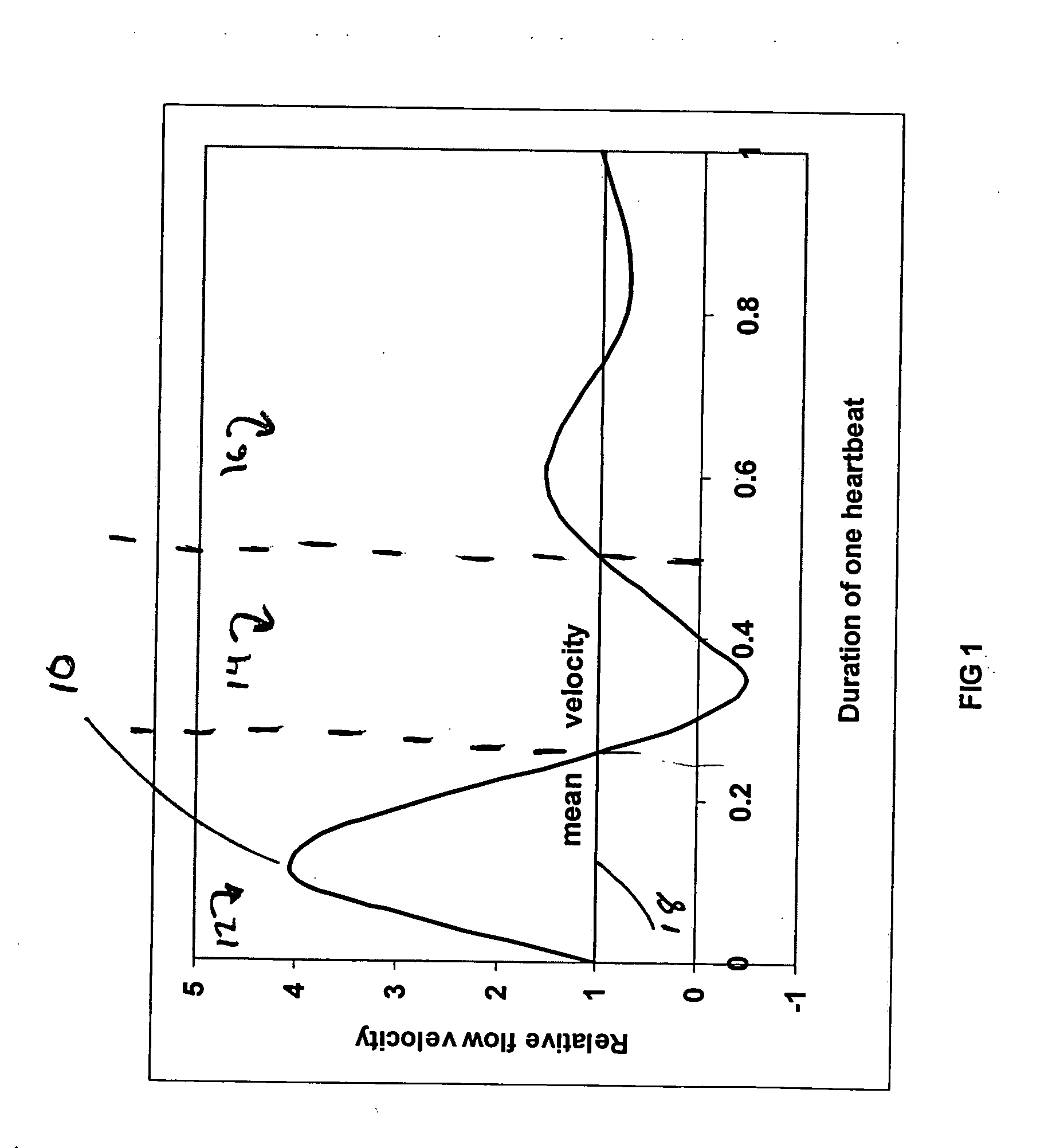 Method and system for quantification of arterial stenosis