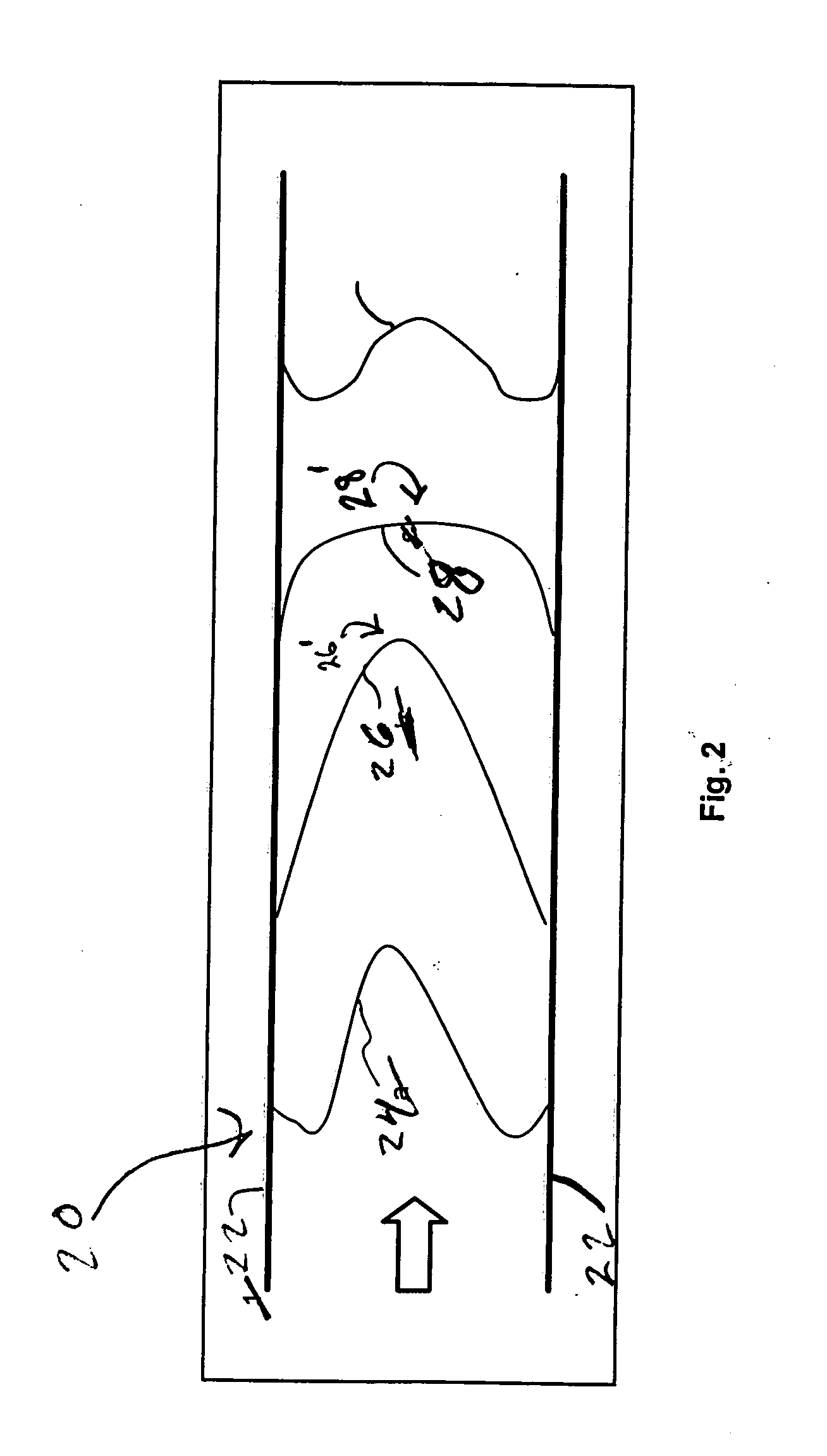 Method and system for quantification of arterial stenosis