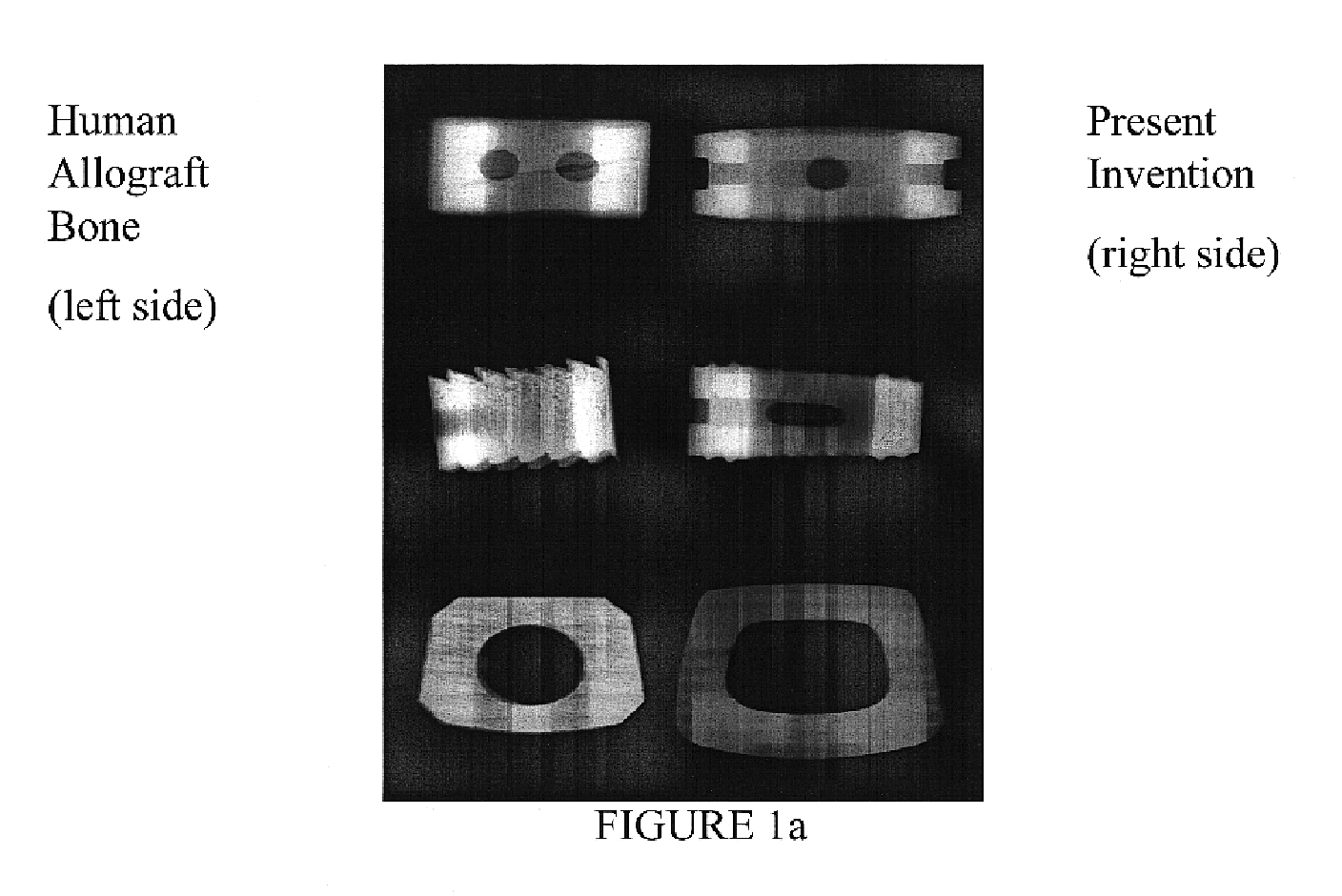 Bioactive spinal implant material and method of manufacture thereof