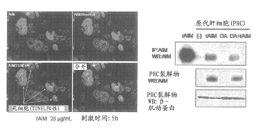 Prophylactic or therapeutic agent for hepatic diseases