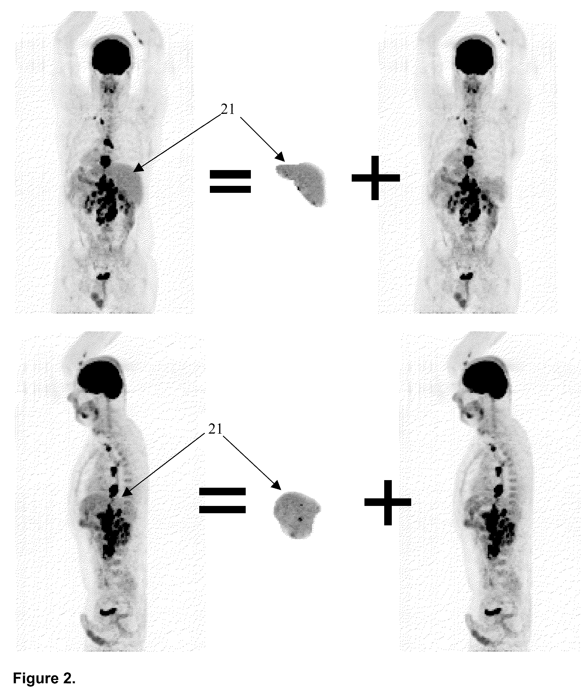 System and Method for Additive Spatial/Intensity Decomposition of Medical Images