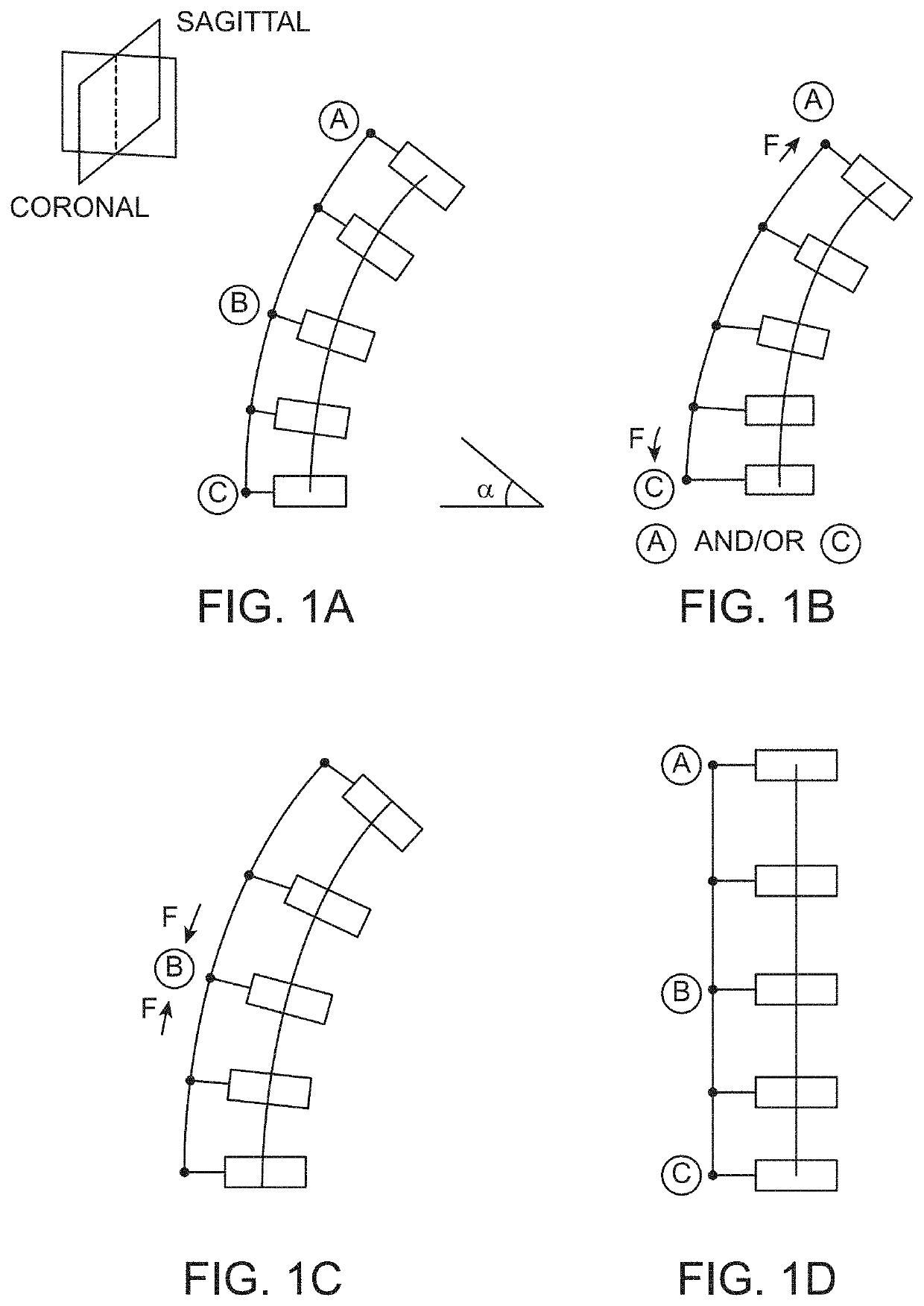 Spinal Curvature Modulation Systems and Methods