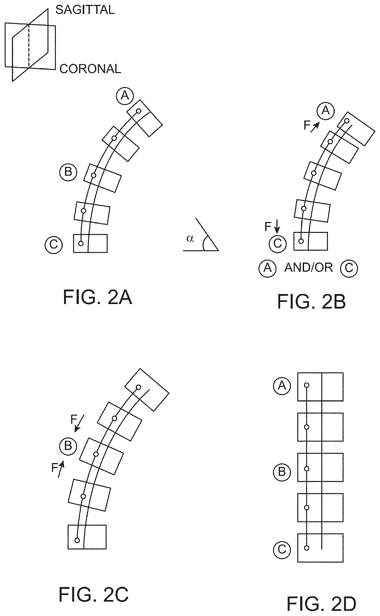 Spinal Curvature Modulation Systems and Methods