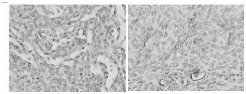 Pharmaceutical composition for warming kidney and tonifying yang