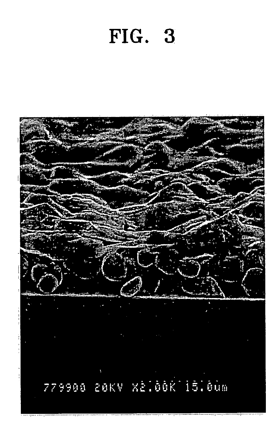 Field emission backlight device