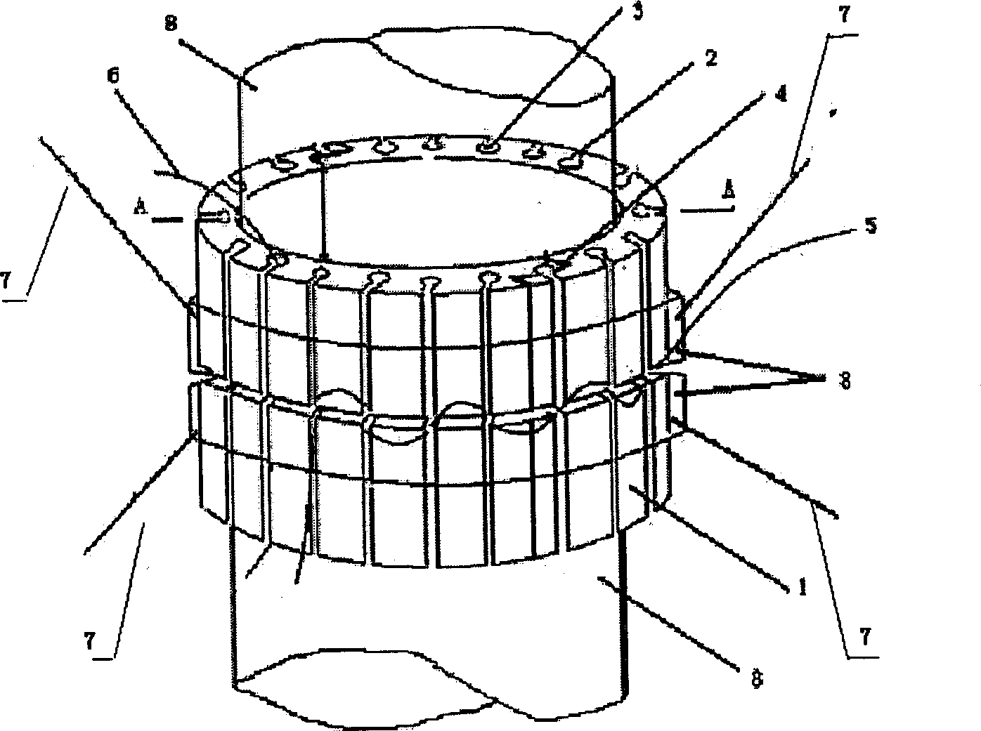 Auxiliary ring for surgical anastomosis