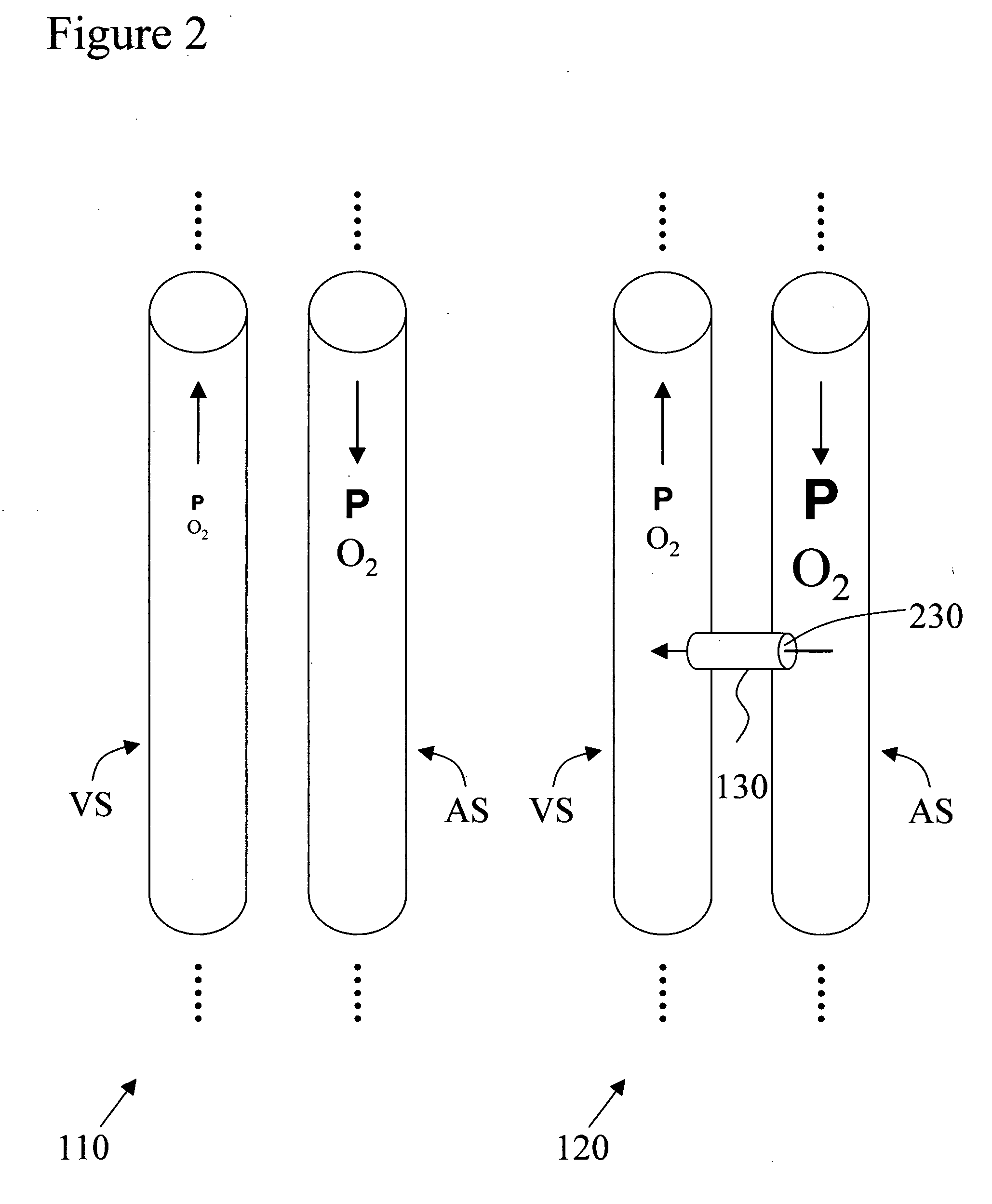 Implantable arterio-venous shunt devices and methods for their use