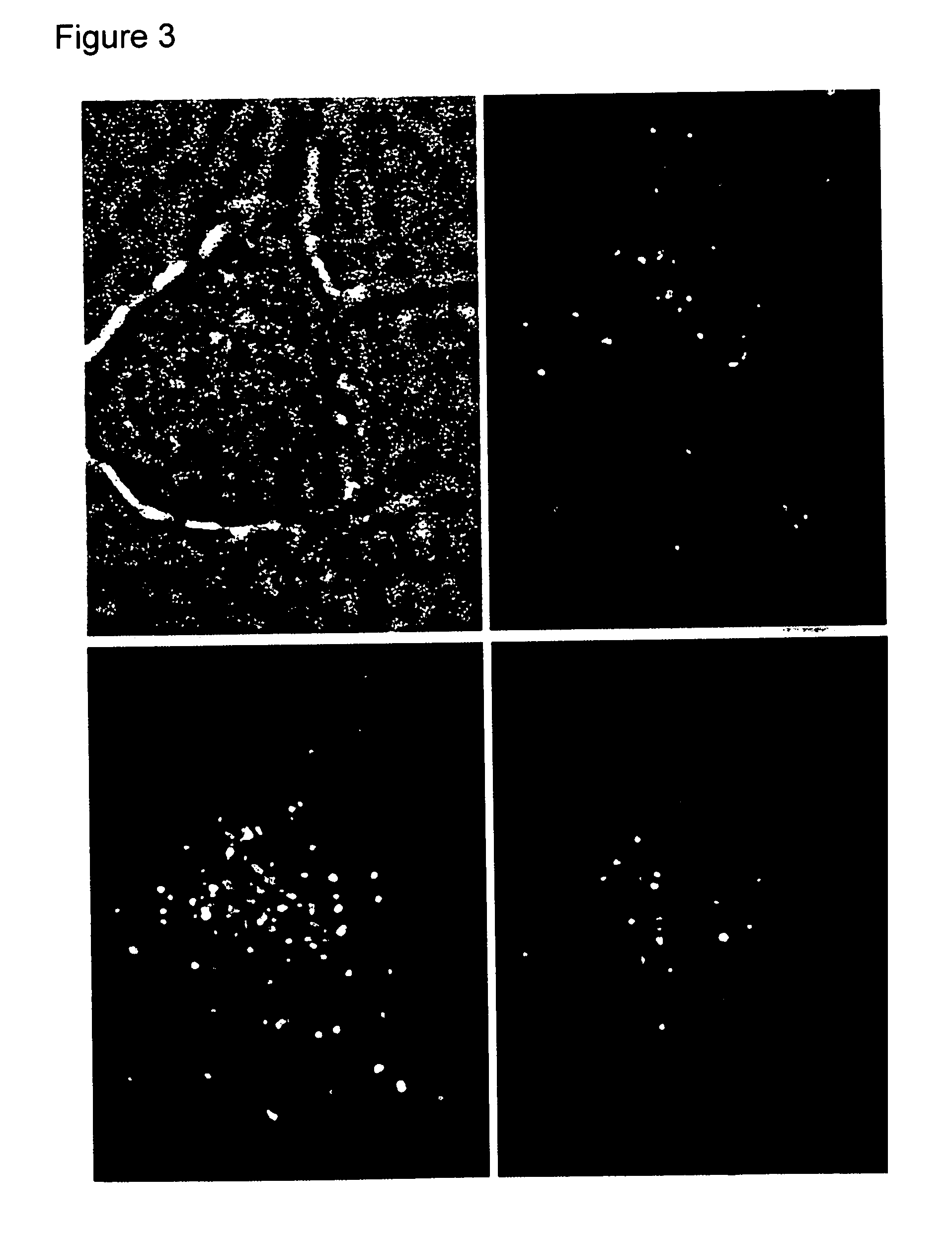 Zinc binding compounds and their method of use