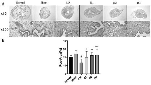 Application of doraglutide to medicine for treating and preventing intrauterine adhesion