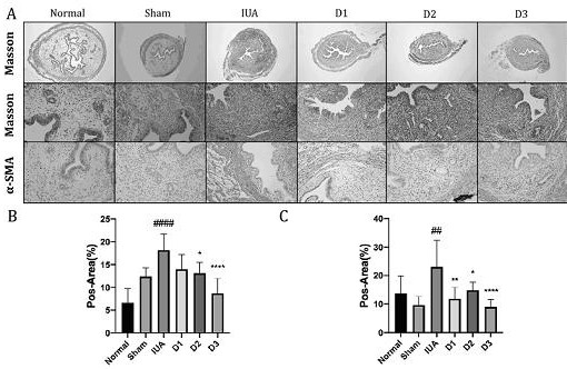 Application of doraglutide to medicine for treating and preventing intrauterine adhesion