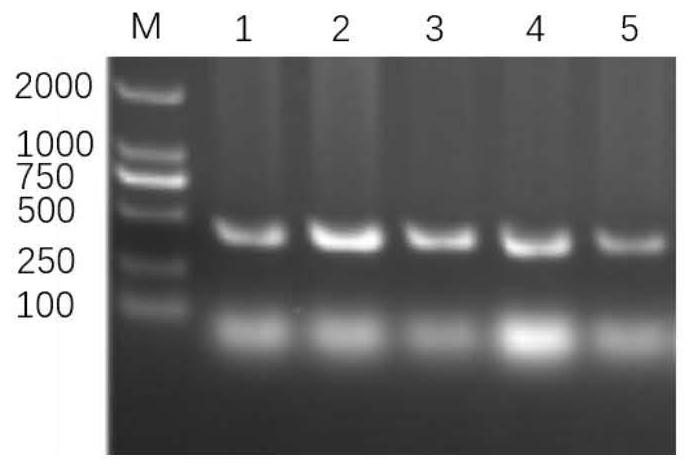 Soybean GmEF1B gene mutant plant as well as preparation method and application thereof