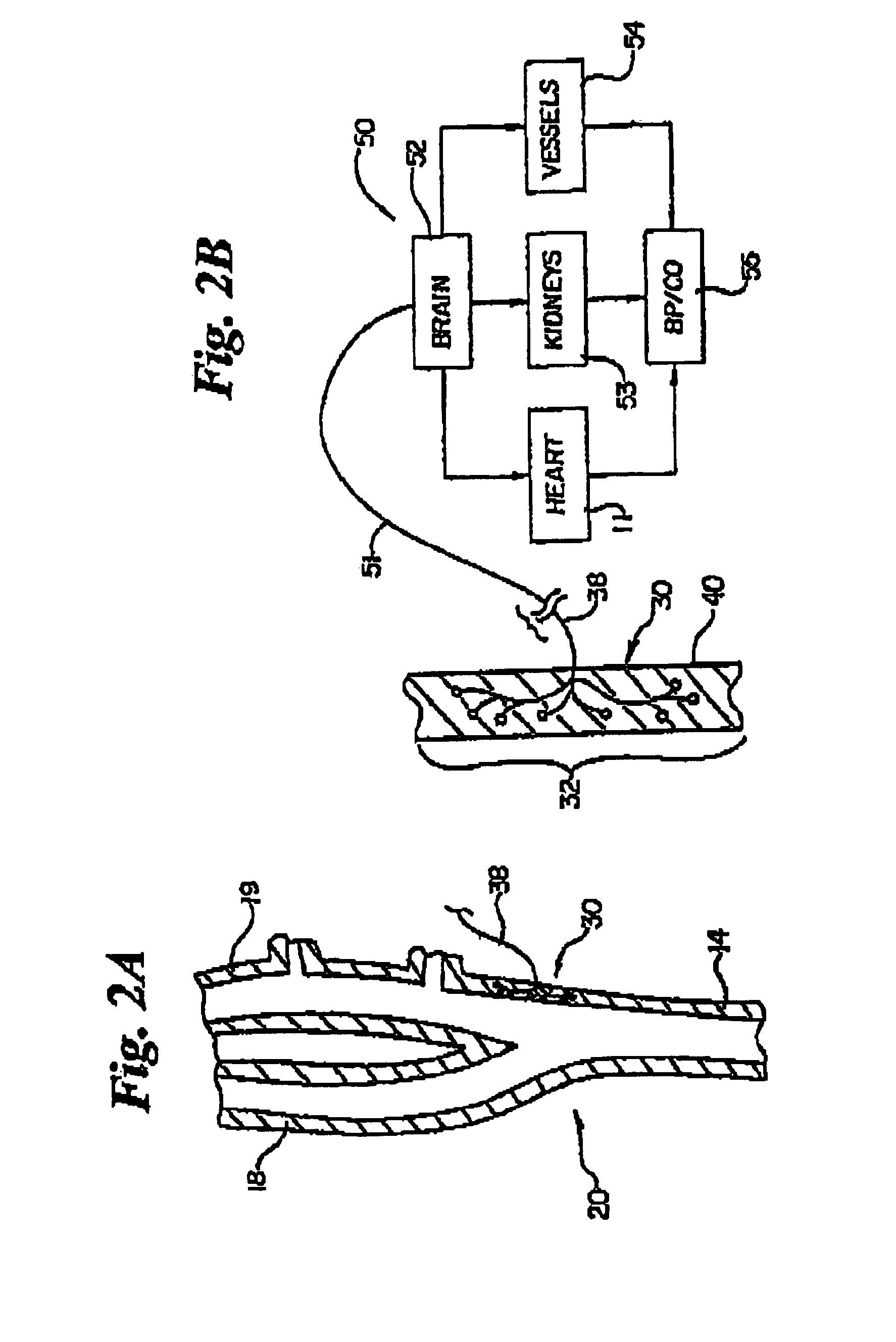 Mapping methods for cardiovascular reflex control devices