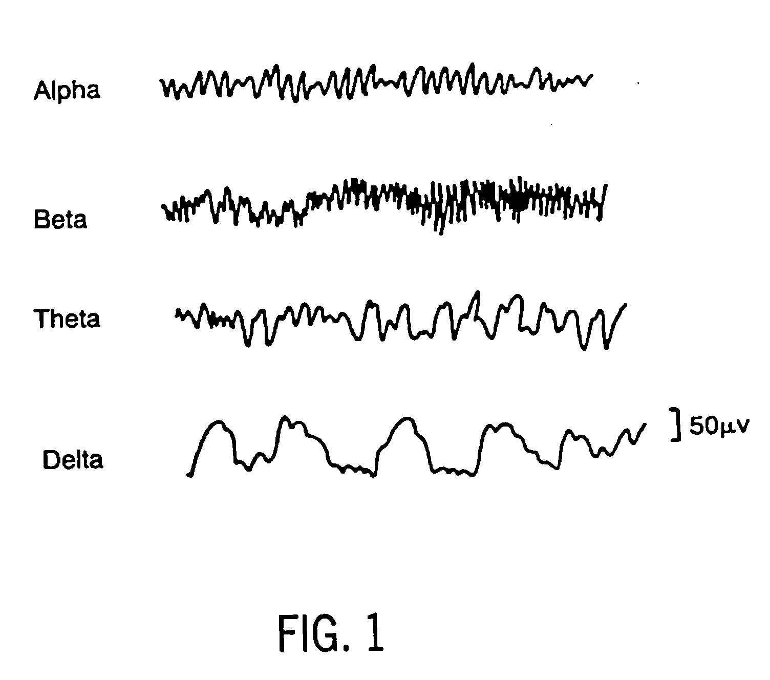 Method and apparatus for determining the cerebral state of a patient using generalized spectral entropy of the EEG signal