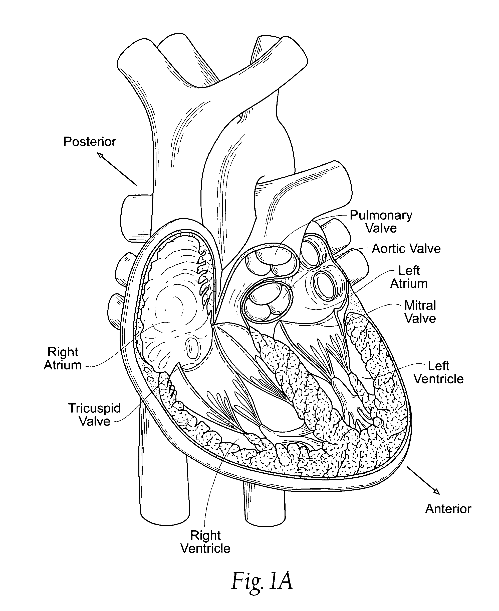 Devices, systems, and methods for retaining a native heart valve leaflet